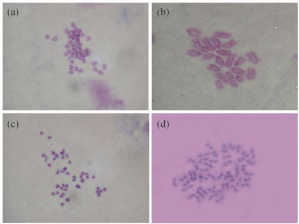 Progress in studies of sex determination mechanisms and sex 